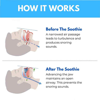 THE SOOTHIE™ ANTI SNORING MOUTHPIECE